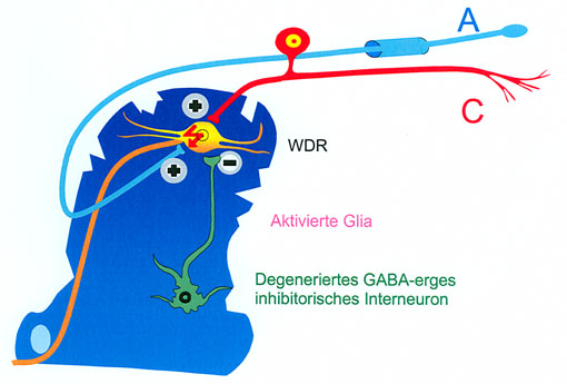 Prof. Dr. Ralf Baron: Zentrale neuropathische Schmerzen
